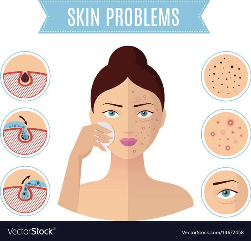 How to treat skin problems.