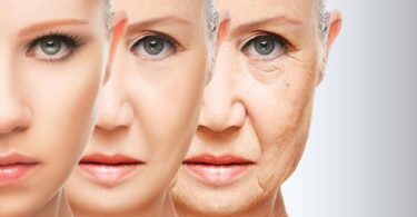 Understanding How Your Skin Changes During Menopause