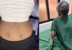 Lady lands in the hospital after getting a back dimple piercing