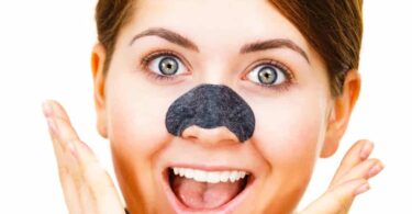 How to Get Rid of Blackheads