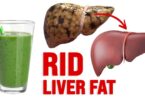 7 Foods To Avoid To Treat Fatty Liver