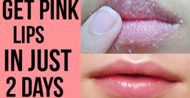 How To Naturally Make Your Lips Pink And Soft