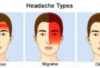 Migraines vs. tension headaches vs. cluster headaches