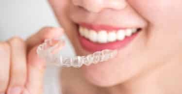 How much is Invisalign with and without Insurance?