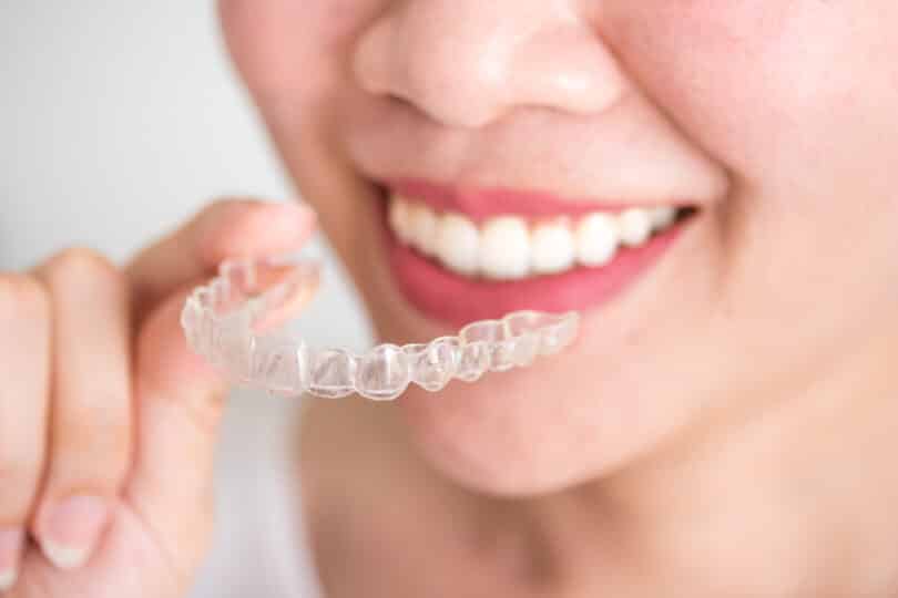 How much is Invisalign with and without Insurance?