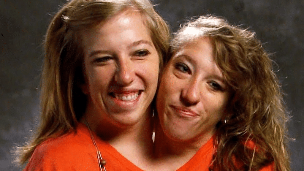 Where are Conjoined Twins Abby and Brittany Hensel? — citiMuzik