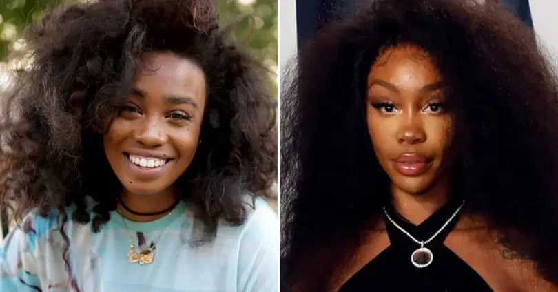 Did SZA Undergo Plastic Surgery? Unveiling the Truth Behind the Plastic Surgery Rumors