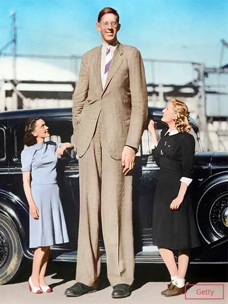 Robert Wadlow Cause of Death: The Gentle Giant's Last Stand