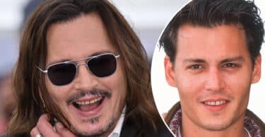 Johnny Depp Teeth Before and After