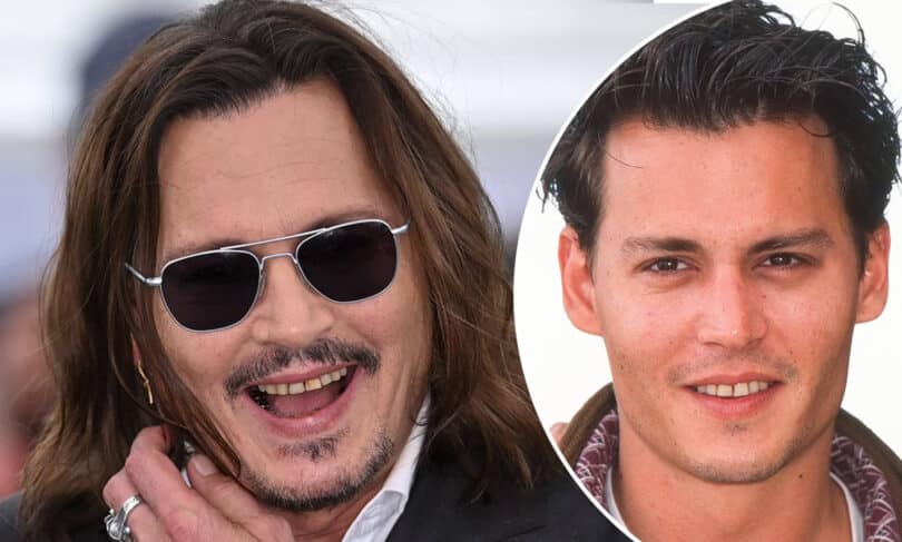 Johnny Depp Teeth Before and After