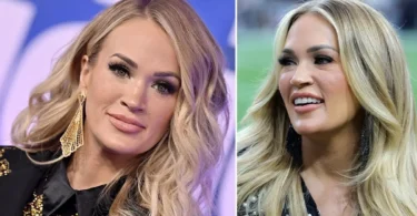 Carrie Underwood Plastic Surgery