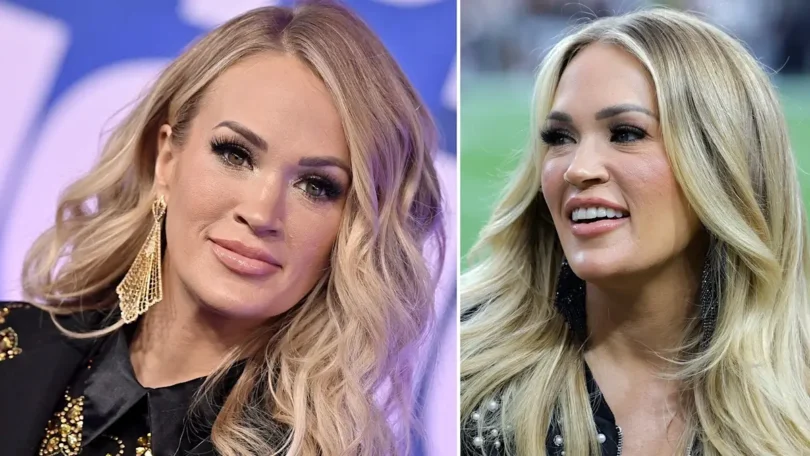 Carrie Underwood Plastic Surgery