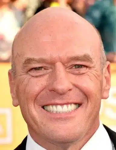 Dean Norris Net Worth