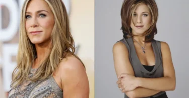 Jennifer Aniston Plastic Surgery