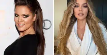 Khloe Kardashian Plastic Surgery