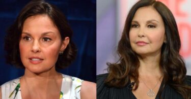 Ashley Judd Plastic Surgery