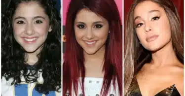 Ariana Grande Plastic Surgery