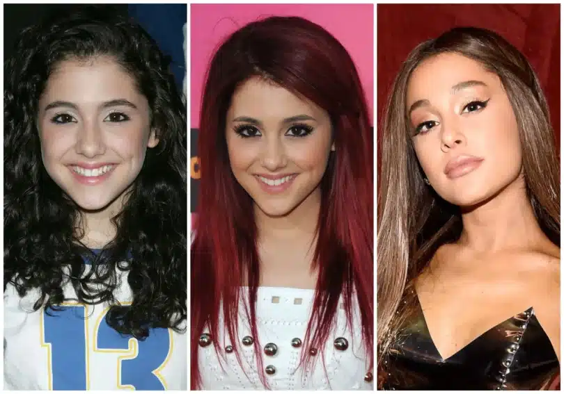 Ariana Grande Plastic Surgery