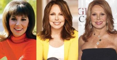 Marlo Thomas Plastic Surgery