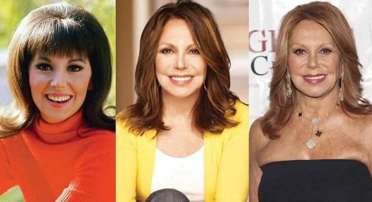 Marlo Thomas Plastic Surgery