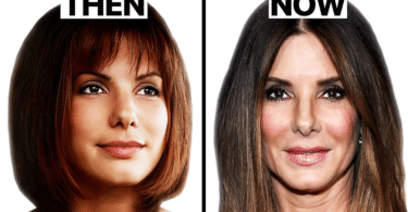 Sandra Bullock Plastic Surgery