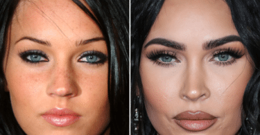 Megan Fox Plastic Surgery