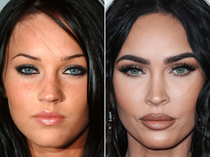 Megan Fox Plastic Surgery