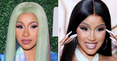 Cardi B Plastic Surgery