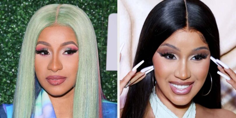 Cardi B Plastic Surgery