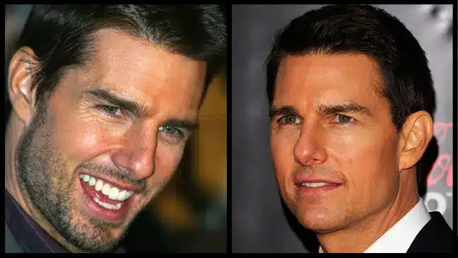 Tom Cruise Plastic Surgery: The Action Star's Age-Defying Secrets ...