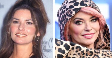 Shania Twain Plastic Surgery