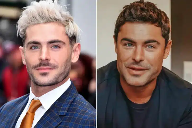 Zac Efron Plastic Surgery The Actor's Chiseled Transformation — citiMuzik